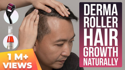 How Derma Rollers Can Help Treat Hair Loss