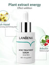 ACNE TREATMENT SERUM