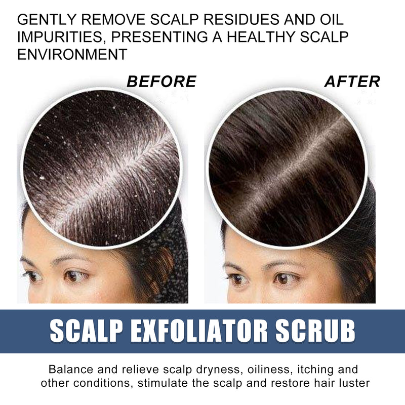 Scalp Exfoliating Scrub