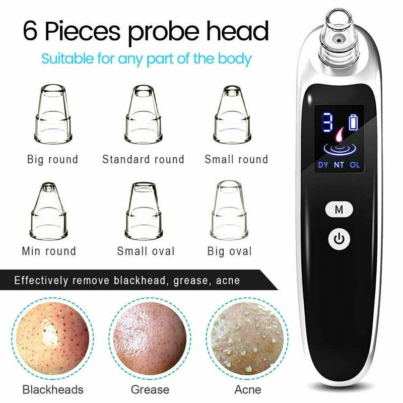 Electric blackhead remover Blackhead Acne Vacuum