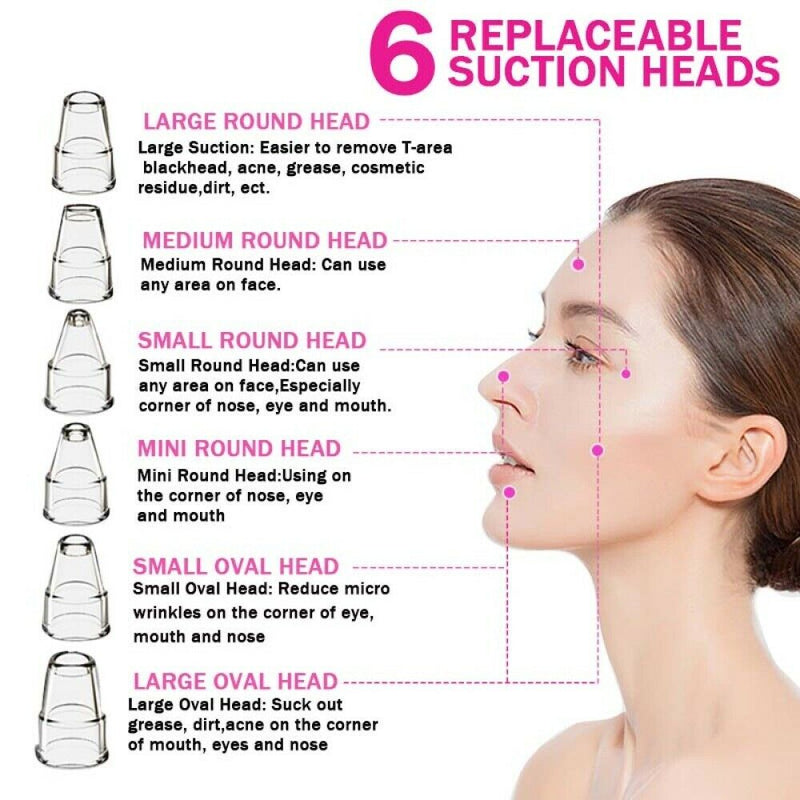 Electric blackhead remover Blackhead Acne Vacuum