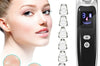 Electric blackhead remover Blackhead Acne Vacuum