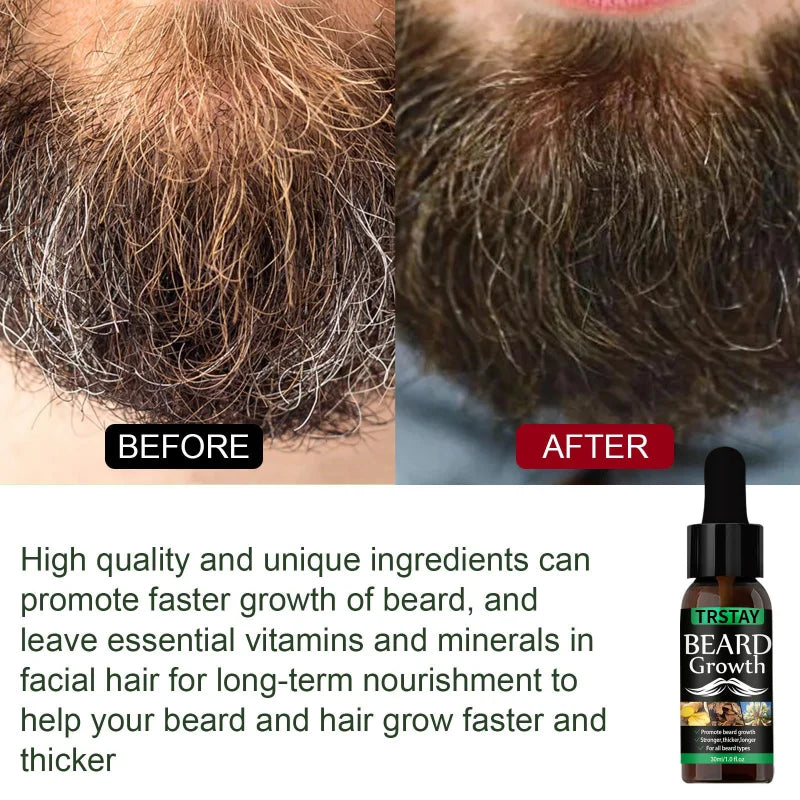 Beard Hair Growth Anti Hair Loss Natural Mustache Regrowth Oil